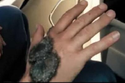 300pxBeschreibung=Ein Mann mutiert zum Pilz